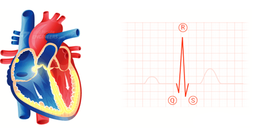 کمپلکس QRS