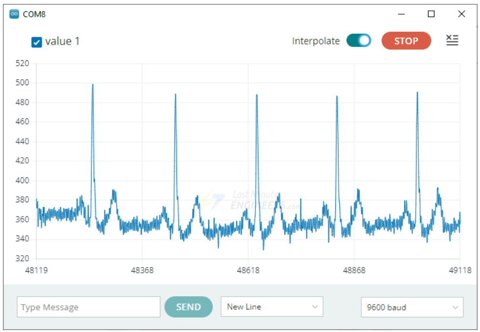 آموزش ساخت دستگاه ECG با Arduino